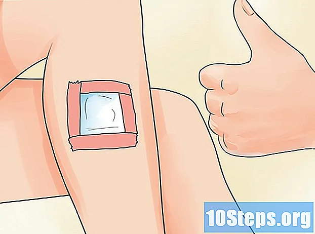 Kako ukloniti traku bez boli