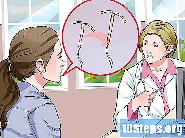 Как да премахнете IUD