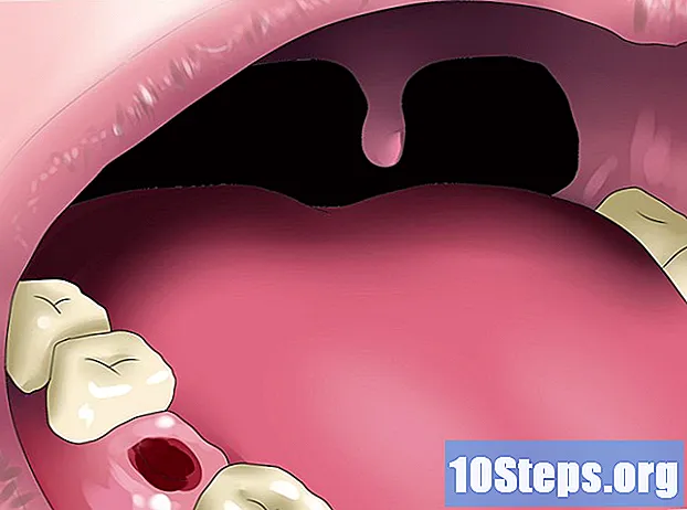 Kako preokrenuti gubitak zubne kosti
