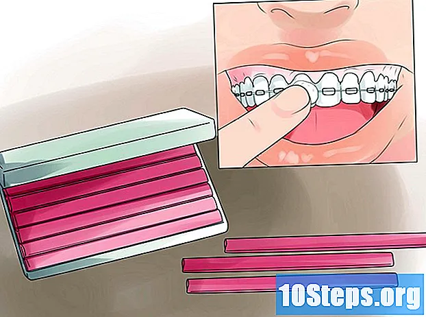 كيف تتغذى بجهاز تقويم الأسنان