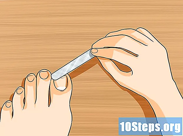 Jak se zbavit žluté nehty