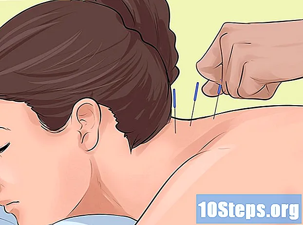 Kako liječiti spondilozu