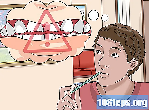 Ako liečiť stratu zubnej skloviny
