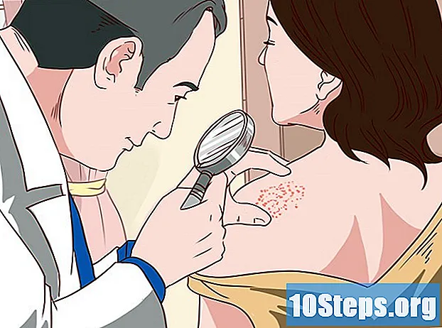 كيفية علاج حكة الجلد بالعلاجات المنزلية