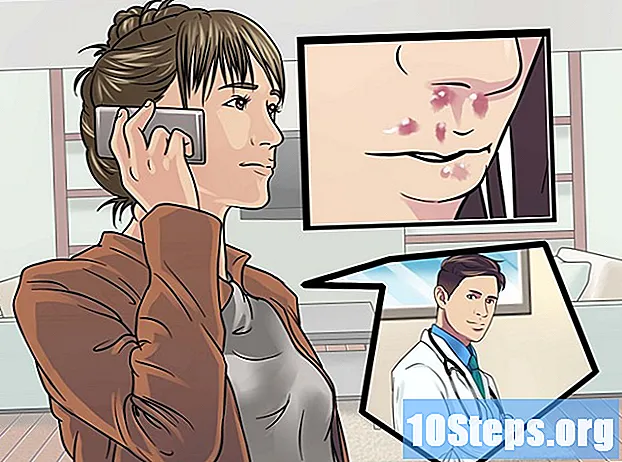 Wie man Herpes auf der Nase behandelt