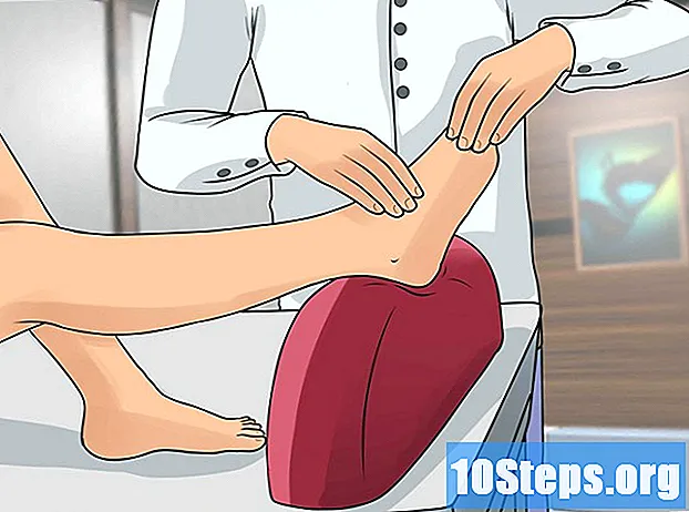 Cómo tratar la neuropatía del pie