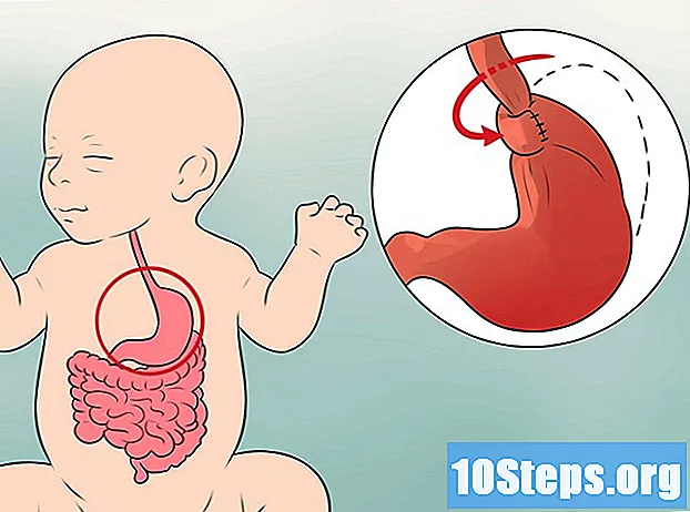 Cum să tratezi refluxul la nou-născuți