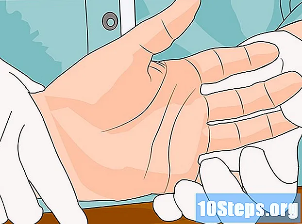 골절 된 손가락 치료 방법