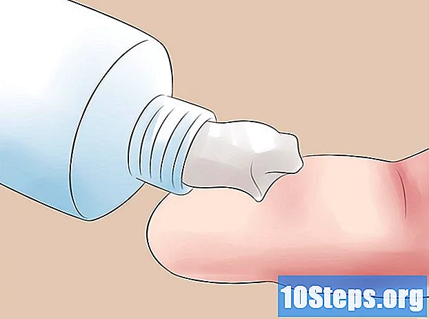 كيفية علاج لدغة دبور