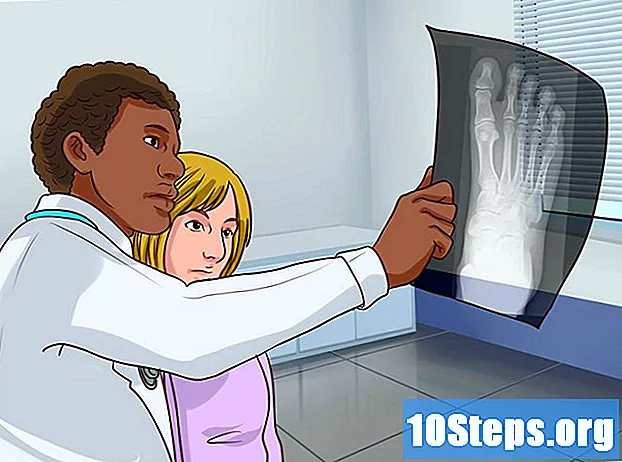 Wie man einen gebrochenen Zehennagel behandelt